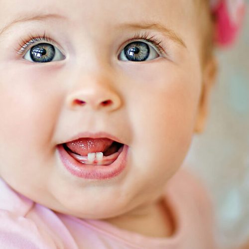 Bebeklerde Diş Çıkarma Döneminde Neler Yapılmalı ?